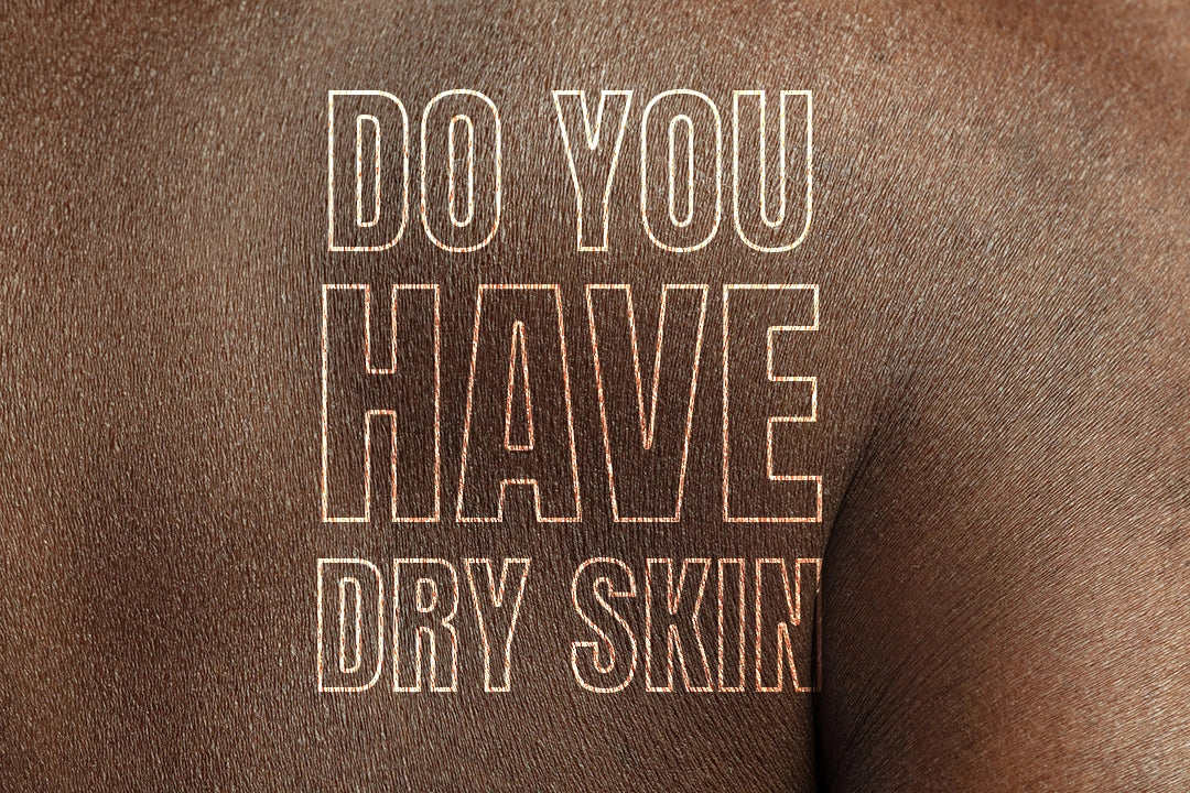 Extra Oil isn’t the Answer to your Dry Skin, Here is What is.